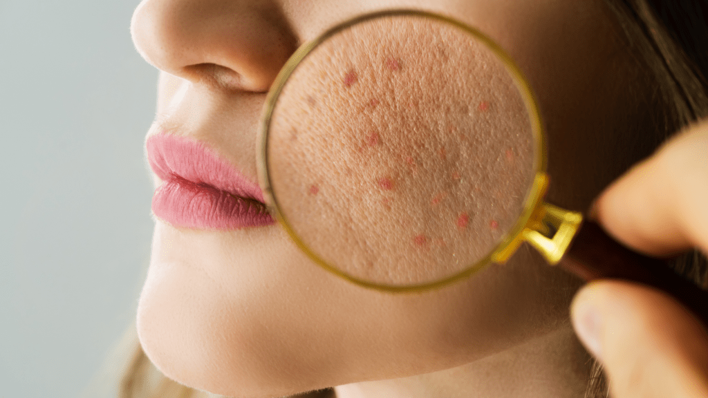 cuando-acudir-al-dermatologo
