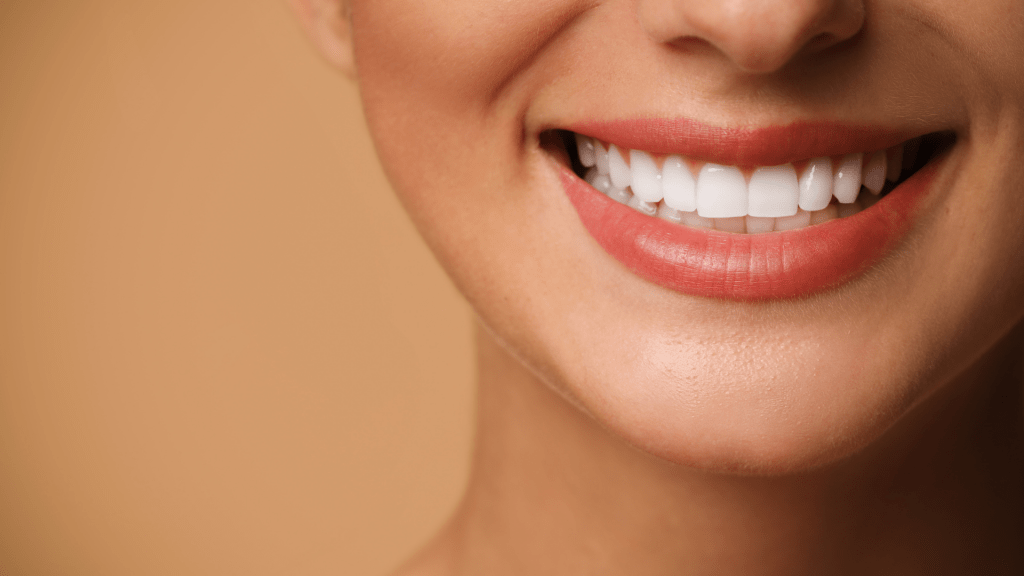 carillas-dentales-en-gran-canaria