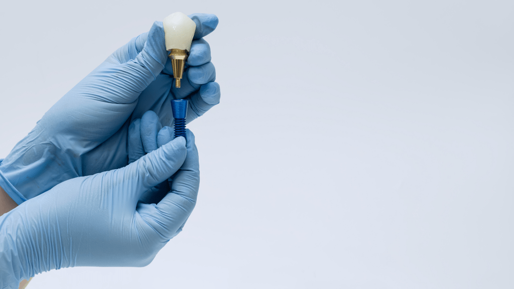 implante-dental-en-las-palmas